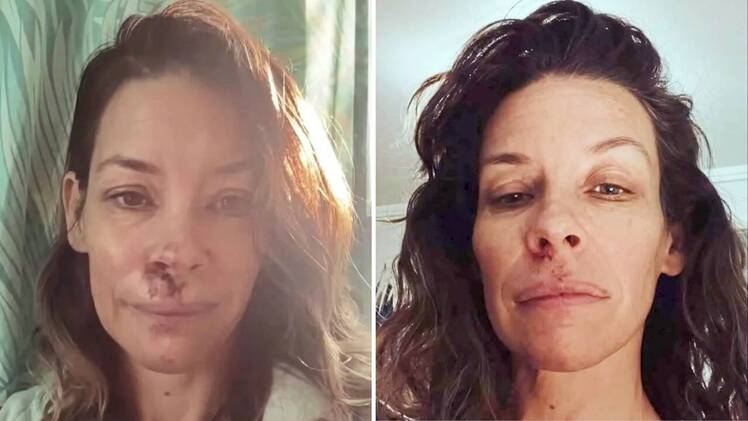 Evangeline Lilly Reveals She’s Facing ‘an Uphill Battle’ After
